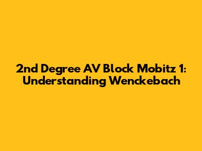 2nd Degree AV Block Mobitz 1: Understanding Wenckebach