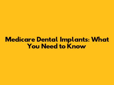 Medicare Dental Implants: What You Need to Know